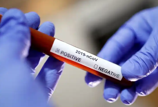 走私罪——孕妇血样跨境走私案